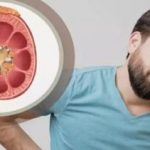 مبتلایان به سنگ کلیه دور این مکمل‌ها را خط بکشند