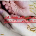 گروه خونی طلایی چیست؛ کدام افراد خون طلایی در ایران دارند؟