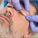 سن مناسب عمل بلفاروپلاستی چه سنی است؟