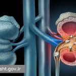 علائم هشدار دهنده سرطان یا نارسایی کلیه را نادیده نگیرید