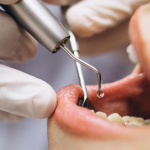 تأثیر جراحی لثه بر سلامت عمومی بدن
