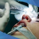 جراحی بینی در شیراز؛ فرایند زیبایی متوازن و چشم نواز