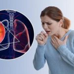 ریه‌ها را در هنگام آلودگی هوا این طور پاکسازی کنید