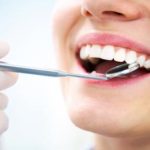 تغییر رنگ دندان به این شکل نشانه مشکلات و بیماری های جدی در بدن است