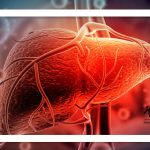 ابتلای جنجالی مدافع پرسپولیس به هپاتیت B / هر آنچه باید درباره این بیماری بدانید