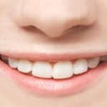 آدامس بدون قند، نوشدارویی برای بوی ناخوشایند دهان؟