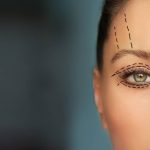 سن مناسب برای انجام جراحی پلک + تا چه سنی می توان انجام داد؟