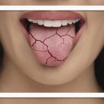 تاثیر اوزمپیک بر سلامت دهان و دندان