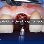 عوارض ایمپلنت دندان؛ هر آنچه باید قبل از انجام بدانید!
