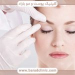بلفاروپلاستی بدون درد و بخیه