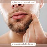 بهترین کلینیک کاشت ریش در تهران
