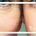 چرا برخی پیرتر از سن واقعی خود نشان می‌دهند؟