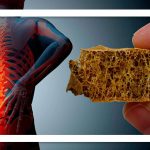 علل پوکی استخوان؛ از کم‌وزنی تا دخانیات و الکل