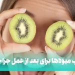 مصرف میوه و آب میوه بعد از عمل جراحی چشم + جدول
