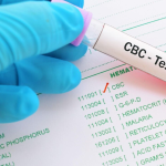 تفسیر CBC و شاخص‌های آن در کم‌خونی