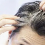 راهکارهای مقابله با سفیدی زودرس موها+اینفوگرافی