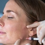 پروفایلو چیست؟ بهترین راه درمان چین و چروک