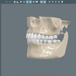 بررسی کامل نسل جدید دستگاه رادیوگرافی دندان؛ تحول در ایمنی و وضوح تصویر