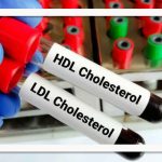 ارتباط LDL پایین با افزایش خطر دیابت نوع ۲