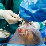 ۸۵ درصد خانواده‌هایی که اهدای عضو را رد می‌کنند، بعدها پشیمان می‌شوند