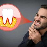 لزوم کشیدن دندان عقل حتی در صورت ظاهر سالم