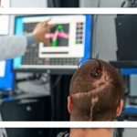 کاشت رابط مغز و رایانه در بیمار مبتلا به فلج کامل برای نخستین‌بار در اروپا