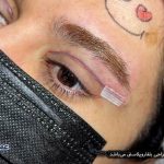 عمل های زیبایی پرطرفدار برای داشتن چهره‌ ای نچرال