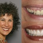 معرفی مقاله های مفید و برتر از مجله آموزشی سلامت دندان