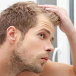درمان ریزش موی سر آقایان در سال 1404 + جدیدترین مقالات علمی