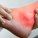 روش های تشخیص پا درد و تست‌های ارتوپدی برای آن