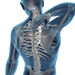 پوکی استخوان و تأثیر آن بر مهره‌ها