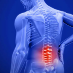 عامل پنهان کمردردهای مزمن مشخص شد