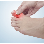 علت ایجاد آرتروز پا و انگشتان