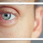 روش های کنترل خشکی چشم در زمستان