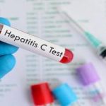 سریع ترین روش تشخیص هپاتیت C تنها در عرض ۱۵ دقیقه